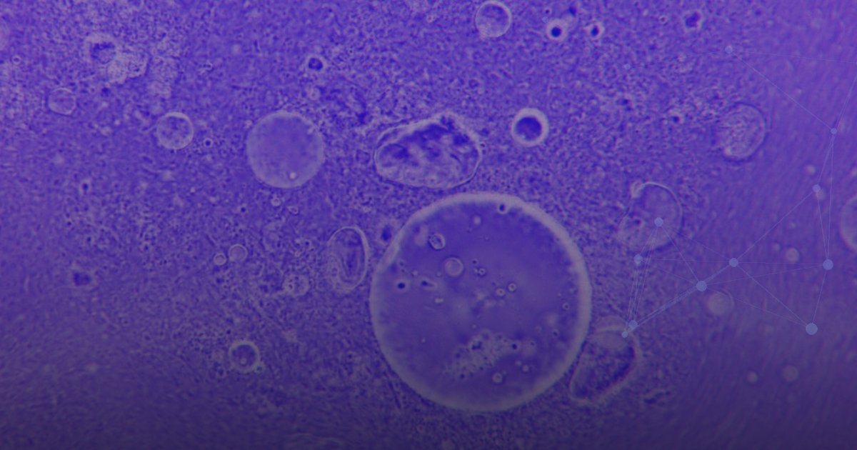 Como ler um laudo de painel molecular em oncologia: guia prático para profissionais e pacientes