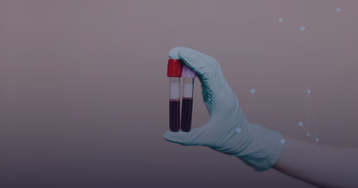 Tecido ou sangue? Como escolher a amostra do teste molecular no câncer